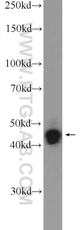 Western Blot (WB) analysis of SH-SY5Y cells using ZNF124 Polyclonal antibody (25216-1-AP)