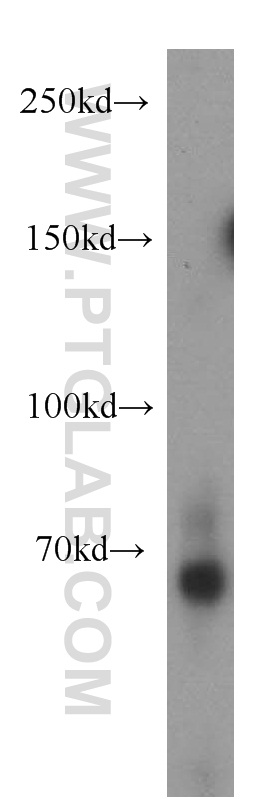 Western Blot (WB) analysis of human testis tissue using ZNF132 Polyclonal antibody (21681-1-AP)