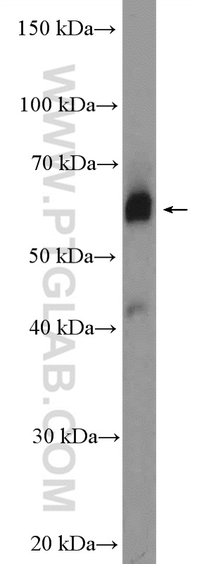 Western Blot (WB) analysis of mouse small intestine tissue using ZNF169 Polyclonal antibody (26344-1-AP)