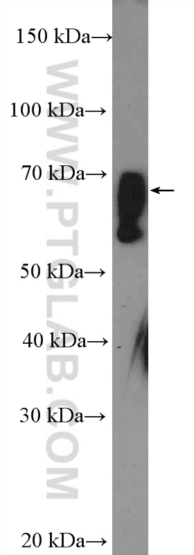 Western Blot (WB) analysis of mouse liver tissue using ZNF169 Polyclonal antibody (26344-1-AP)