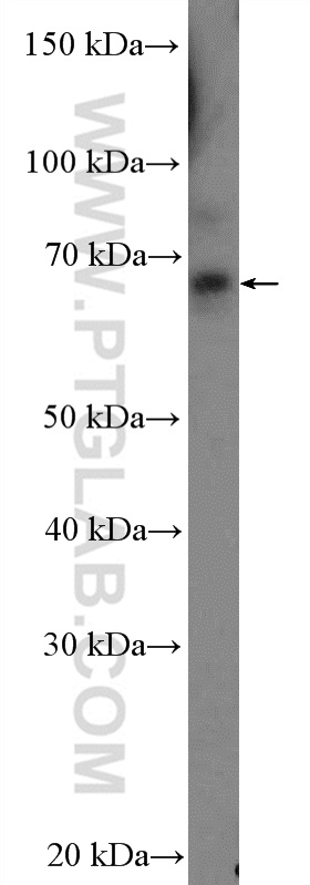 Western Blot (WB) analysis of HeLa cells using ZNF169 Polyclonal antibody (26344-1-AP)