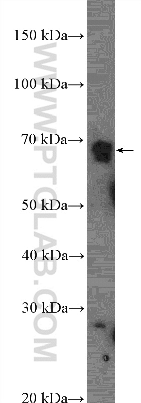 Western Blot (WB) analysis of mouse liver tissue using ZNF169 Polyclonal antibody (26344-1-AP)