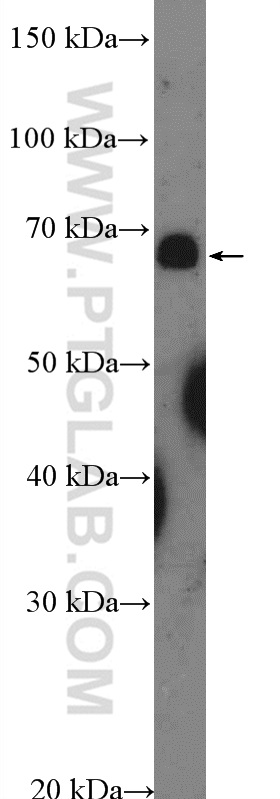 Western Blot (WB) analysis of HepG2 cells using ZNF169 Polyclonal antibody (26344-1-AP)