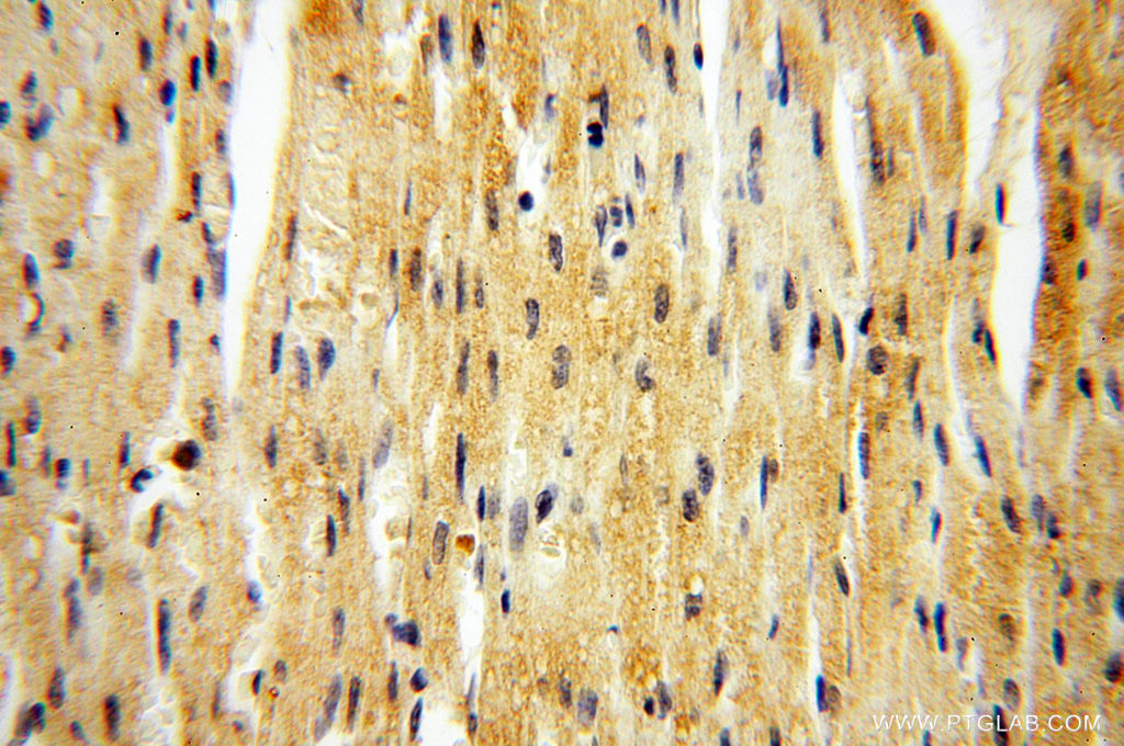 Immunohistochemistry (IHC) staining of human heart tissue using ZNF174 Polyclonal antibody (18157-1-AP)