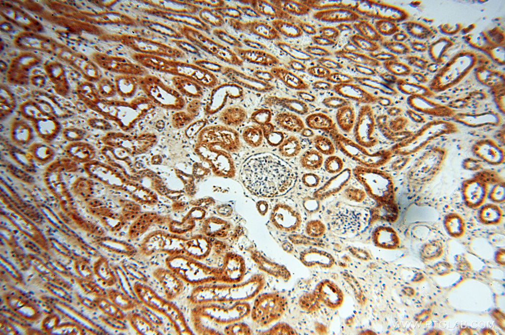 Immunohistochemistry (IHC) staining of human kidney tissue using ZNF174 Polyclonal antibody (18157-1-AP)