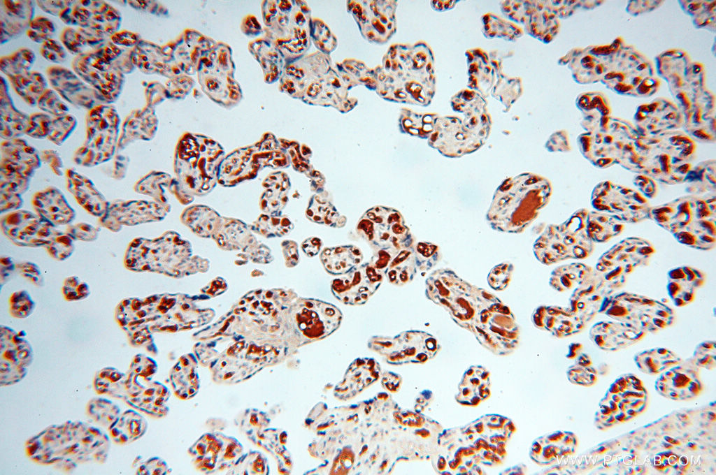 Immunohistochemistry (IHC) staining of human placenta tissue using ZNF174 Polyclonal antibody (18157-1-AP)