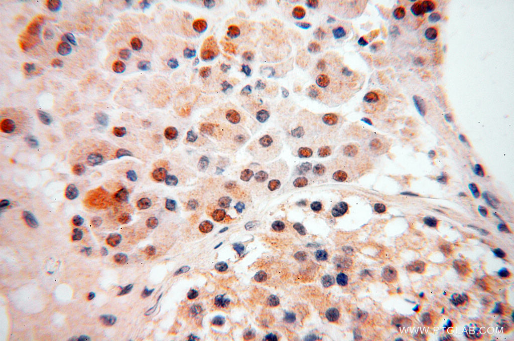 Immunohistochemistry (IHC) staining of human testis tissue using ZNF174 Polyclonal antibody (18157-1-AP)