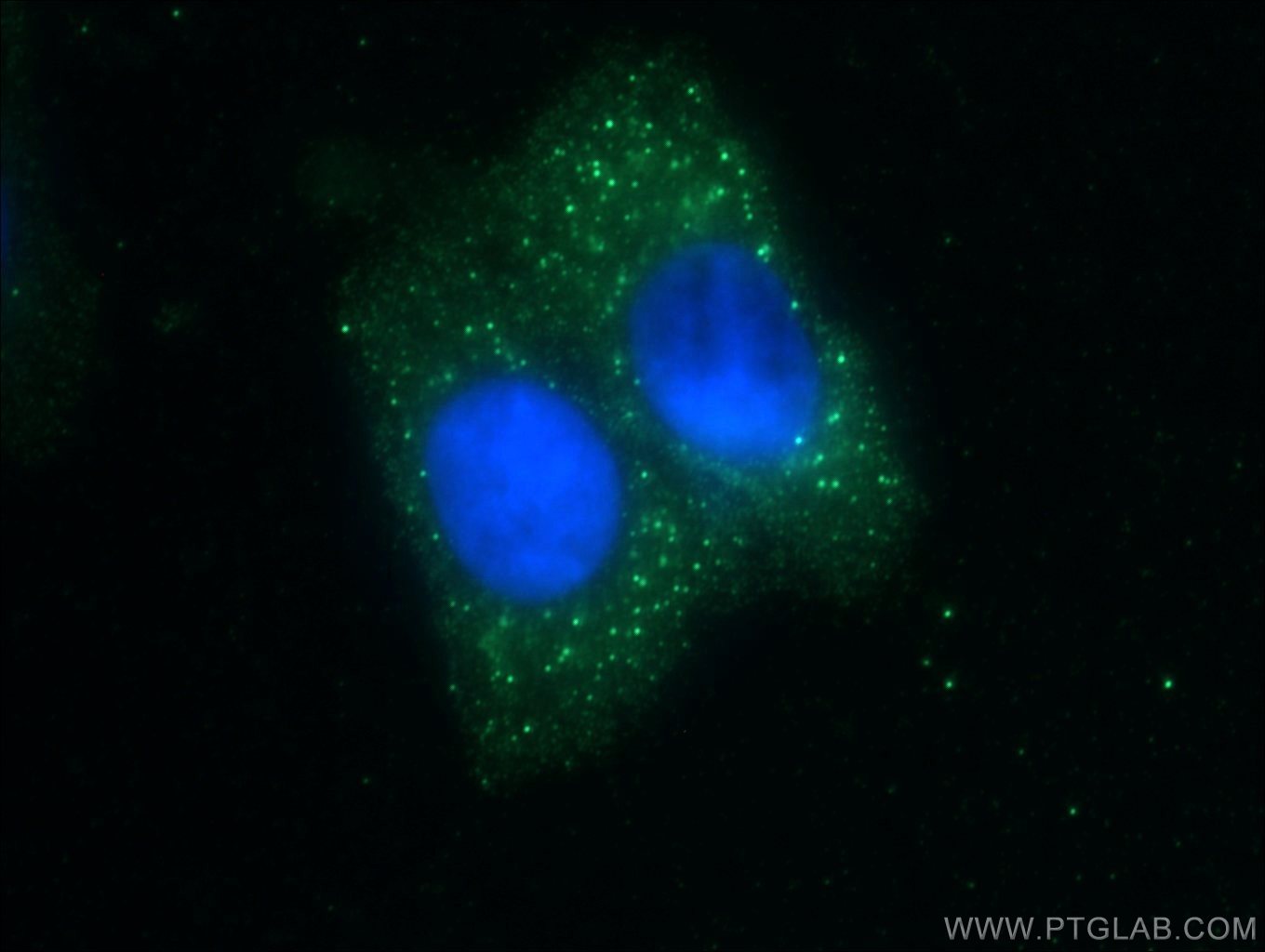 Immunofluorescence (IF) / fluorescent staining of HepG2 cells using ZNF184 Polyclonal antibody (26100-1-AP)