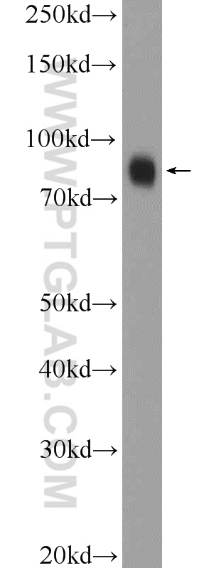 Western Blot (WB) analysis of HepG2 cells using ZNF184 Polyclonal antibody (26100-1-AP)