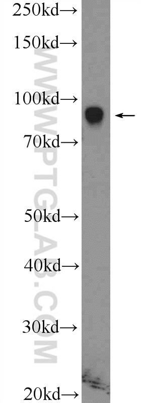 Western Blot (WB) analysis of MCF-7 cells using ZNF184 Polyclonal antibody (26100-1-AP)