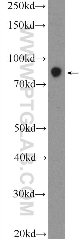 Western Blot (WB) analysis of Jurkat cells using ZNF184 Polyclonal antibody (26100-1-AP)