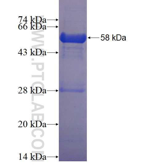 ZNF184 fusion protein Ag23314 SDS-PAGE