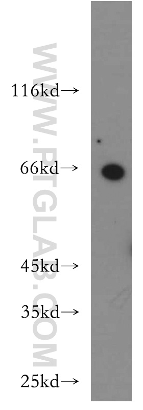 Western Blot (WB) analysis of HeLa cells using ZNF192 Polyclonal antibody (21656-1-AP)