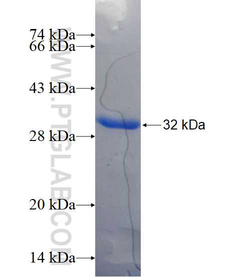 ZNF192 fusion protein Ag17157 SDS-PAGE