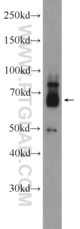 Western Blot (WB) analysis of human heart tissue using ZNF195 Polyclonal antibody (24861-1-AP)