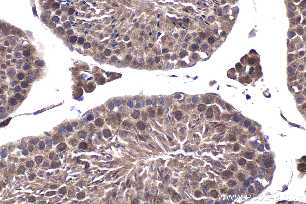 Immunohistochemistry (IHC) staining of mouse testis tissue using ZNF202 Polyclonal antibody (26216-1-AP)