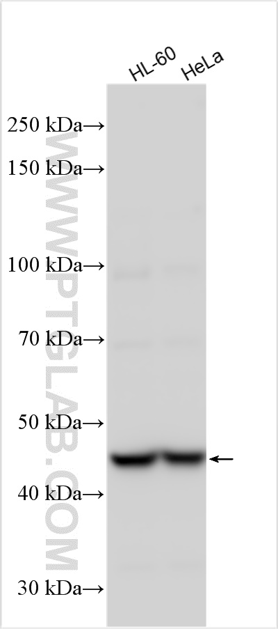 Western Blot (WB) analysis of various lysates using ZNF202 Polyclonal antibody (26216-1-AP)