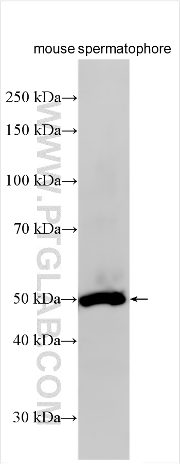 Western Blot (WB) analysis of mouse spermatophore tissue using ZNF202 Polyclonal antibody (26216-1-AP)