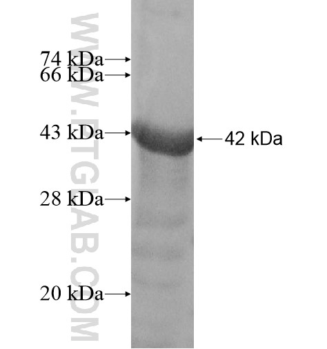 ZNF213 fusion protein Ag15636 SDS-PAGE