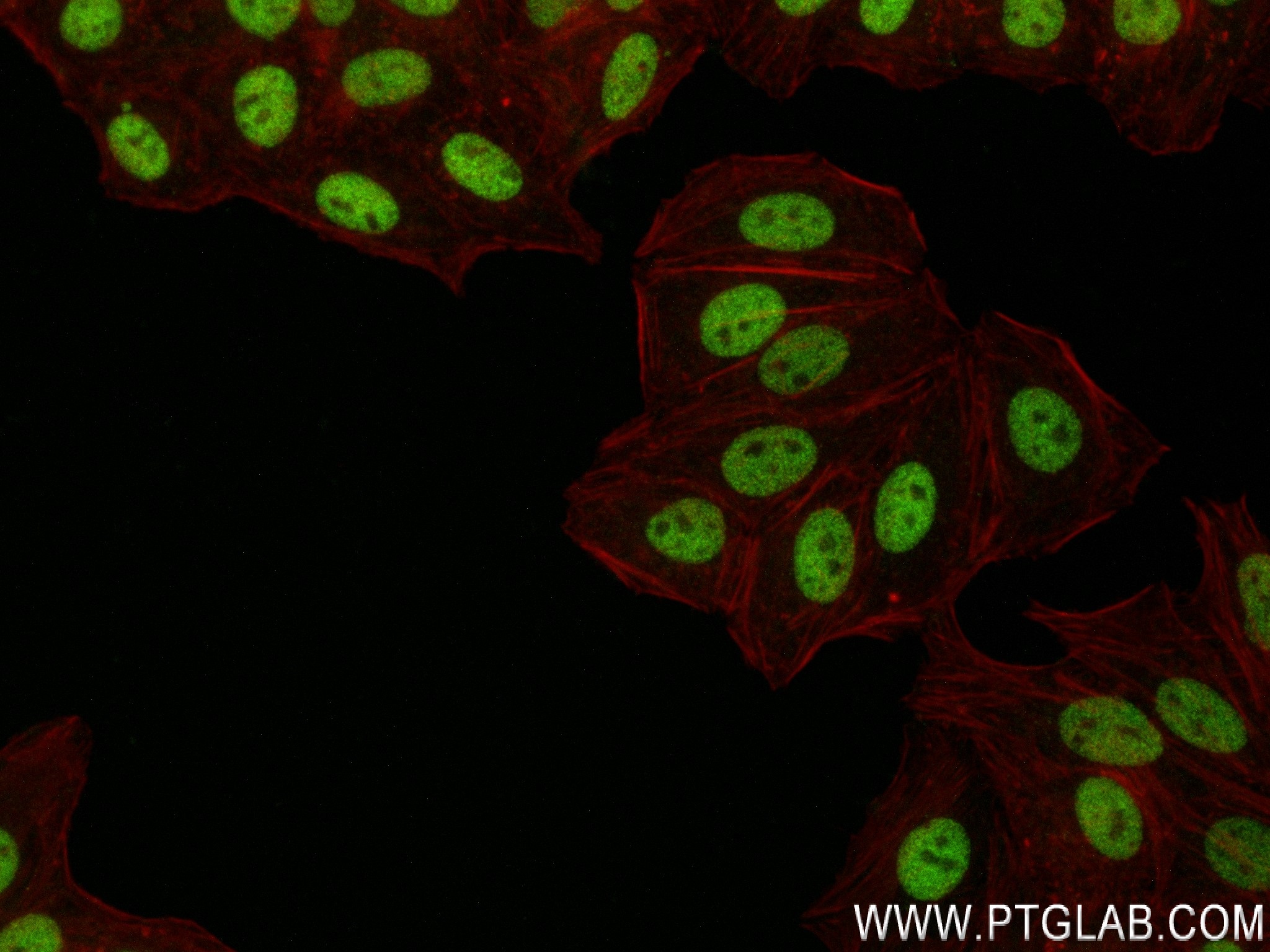 Immunofluorescence (IF) / fluorescent staining of HepG2 cells using ZNF217 Recombinant antibody (84276-1-RR)