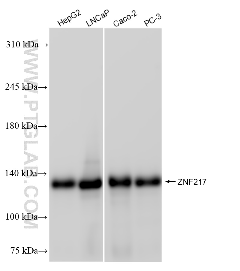 Western Blot (WB) analysis of various lysates using ZNF217 Recombinant antibody (84276-1-RR)