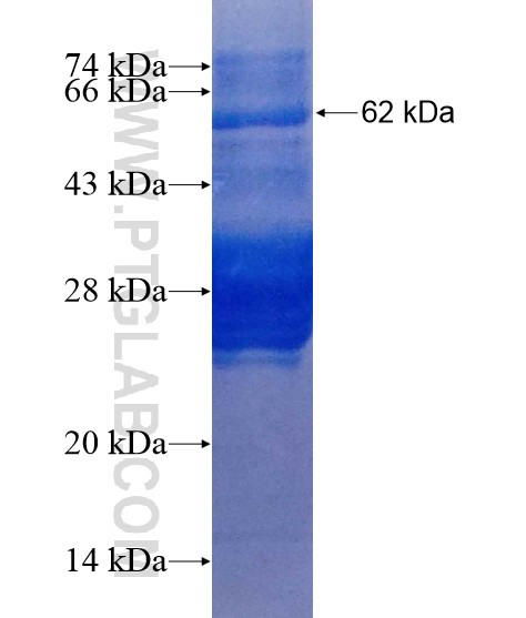 ZNF217 fusion protein Ag19453 SDS-PAGE