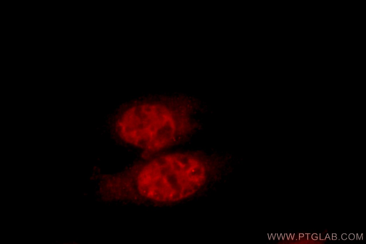 Immunofluorescence (IF) / fluorescent staining of HepG2 cells using ZNF23 Polyclonal antibody (21322-1-AP)