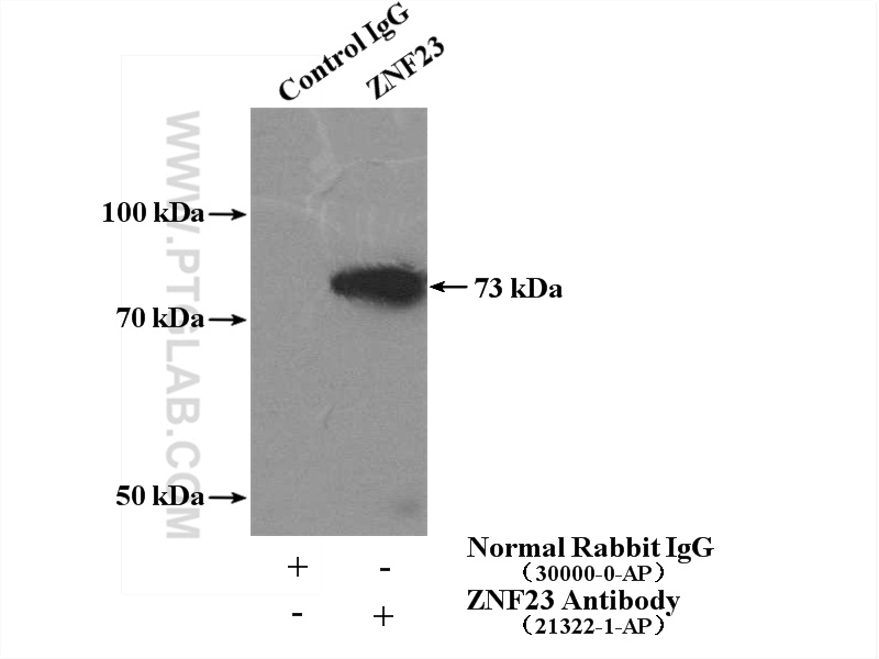 Immunoprecipitation (IP) experiment of mouse brain tissue using ZNF23 Polyclonal antibody (21322-1-AP)