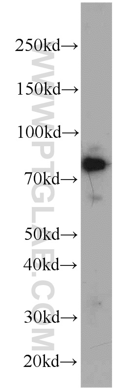 Western Blot (WB) analysis of mouse spleen tissue using ZNF23 Polyclonal antibody (21322-1-AP)