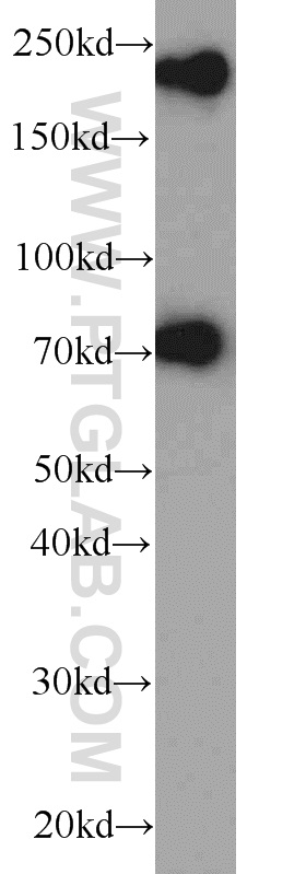 Western Blot (WB) analysis of A2780 cells using ZNF23 Polyclonal antibody (21322-1-AP)