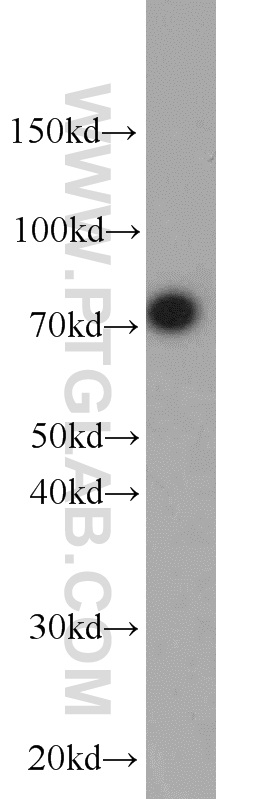 Western Blot (WB) analysis of SKOV-3 cells using ZNF23 Polyclonal antibody (21322-1-AP)