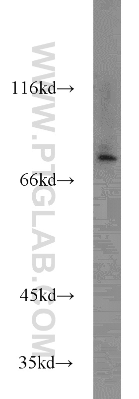 Western Blot (WB) analysis of mouse brain tissue using ZNF23 Polyclonal antibody (21322-1-AP)