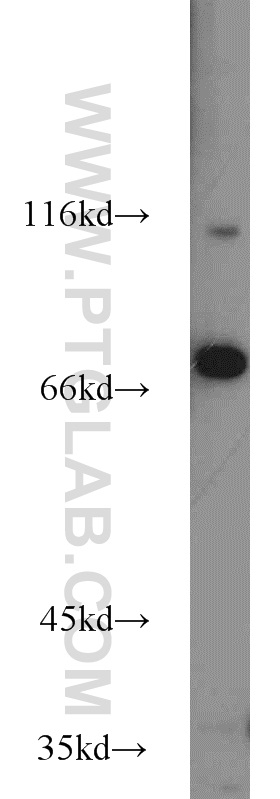 Western Blot (WB) analysis of HeLa cells using ZNF23 Polyclonal antibody (21322-1-AP)