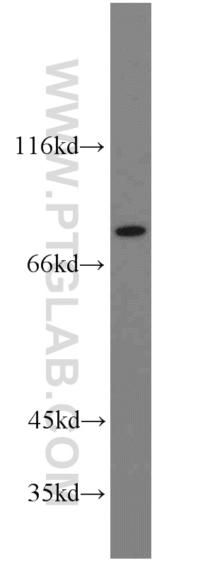 Western Blot (WB) analysis of A2780 cells using ZNF23 Polyclonal antibody (21322-1-AP)