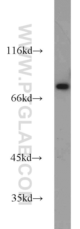 Western Blot (WB) analysis of HepG2 cells using ZNF23 Polyclonal antibody (21322-1-AP)