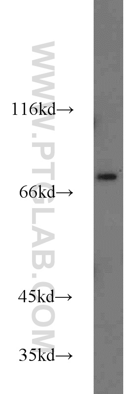 Western Blot (WB) analysis of mouse lung tissue using ZNF23 Polyclonal antibody (21322-1-AP)