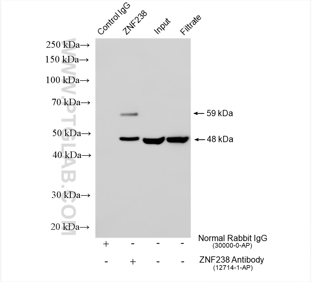 Immunoprecipitation (IP) experiment of rat brain tissue using ZNF238/ZBTB18 Polyclonal antibody (12714-1-AP)