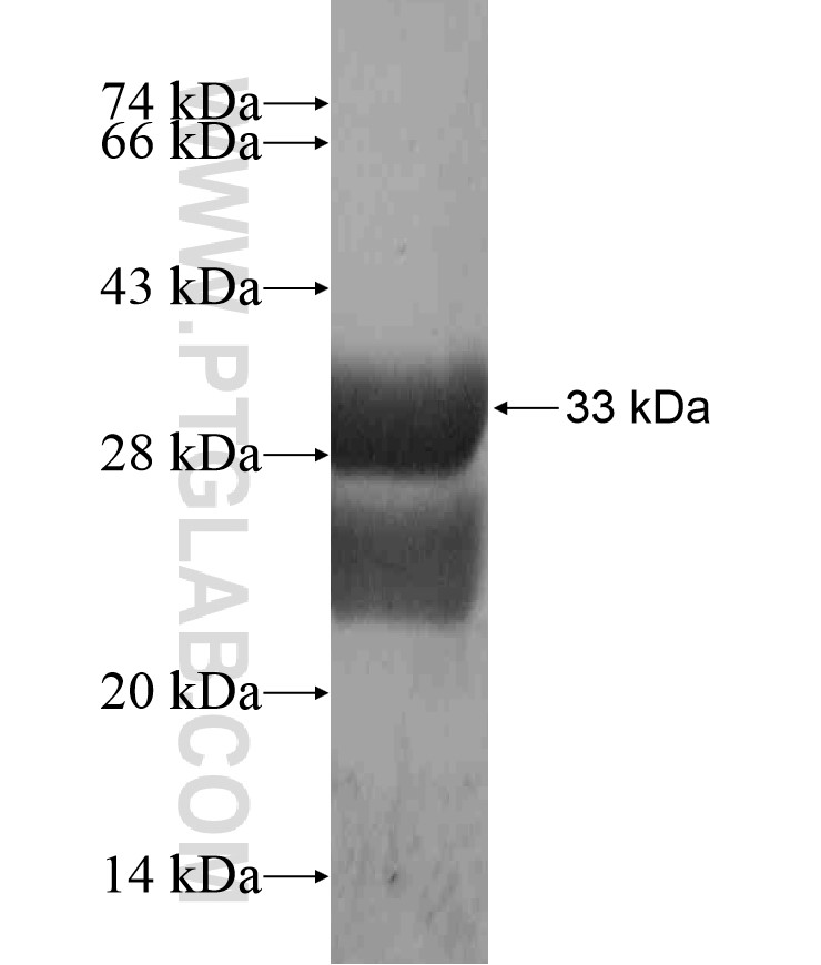 ZNF253 fusion protein Ag18570 SDS-PAGE