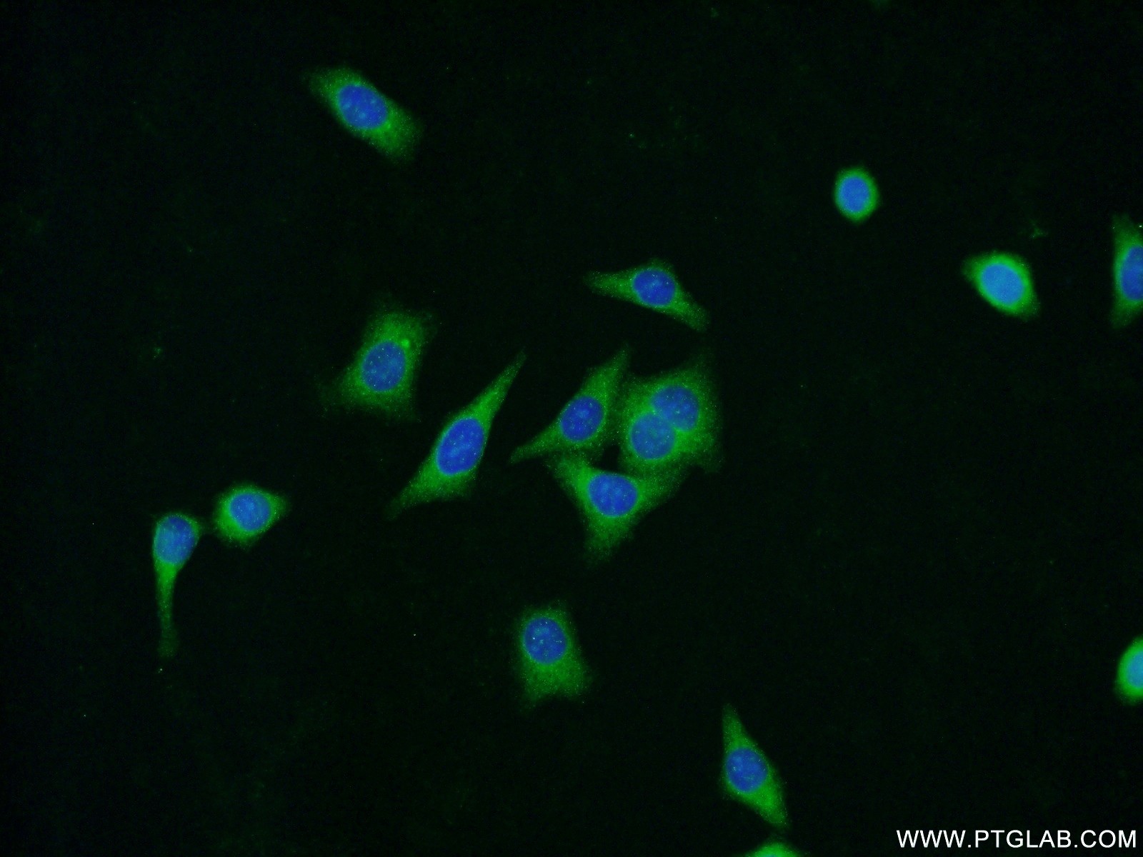 Immunofluorescence (IF) / fluorescent staining of HepG2 cells using ZNF259 Polyclonal antibody (15558-1-AP)