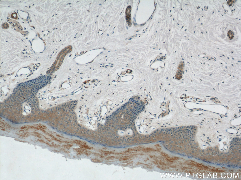 Immunohistochemistry (IHC) staining of human skin tissue using ZNF259 Polyclonal antibody (15558-1-AP)