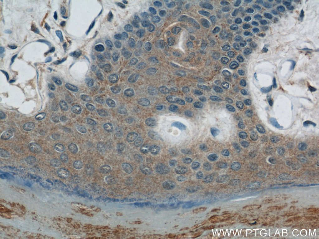 Immunohistochemistry (IHC) staining of human skin tissue using ZNF259 Polyclonal antibody (15558-1-AP)