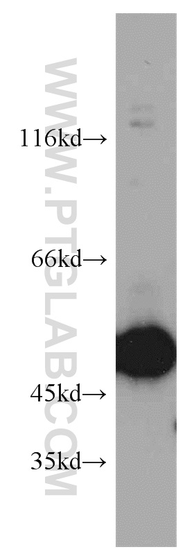 Western Blot (WB) analysis of HeLa cells using ZNF259 Polyclonal antibody (15558-1-AP)