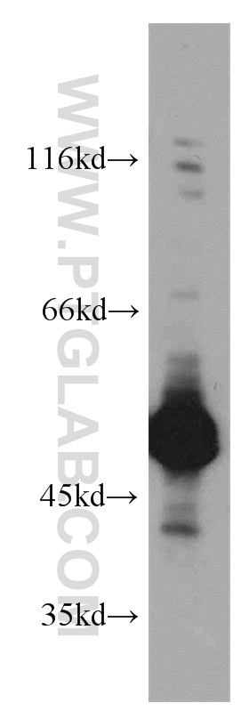 Western Blot (WB) analysis of DU 145 cells using ZNF259 Polyclonal antibody (15558-1-AP)