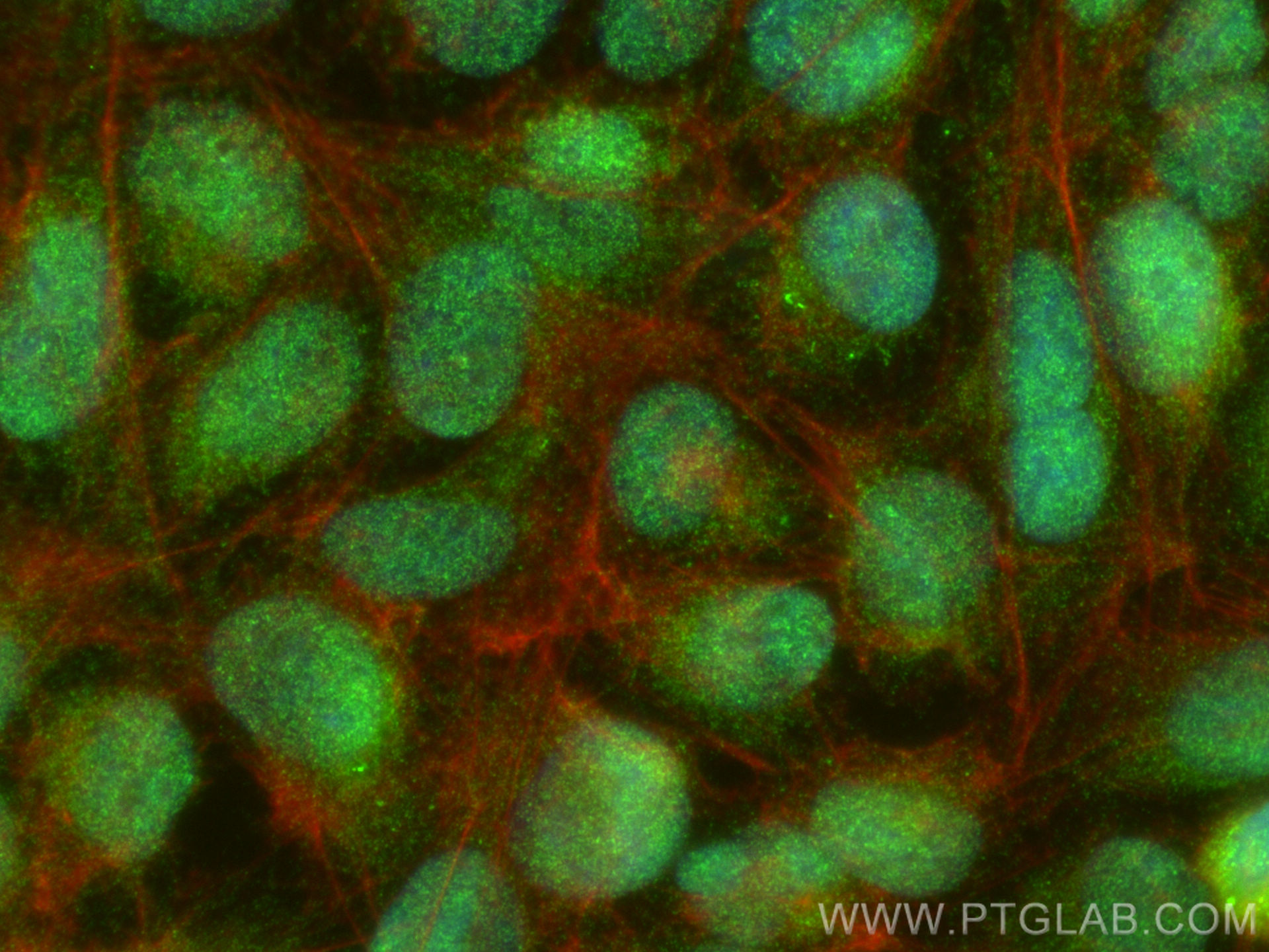 Immunofluorescence (IF) / fluorescent staining of U2OS cells using ZNF263 Polyclonal antibody (21326-1-AP)