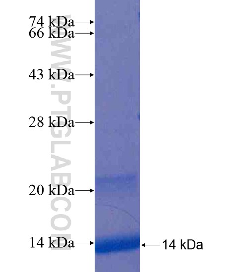 ZNF284 fusion protein Ag20336 SDS-PAGE