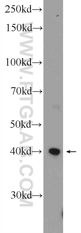 Western Blot (WB) analysis of L02 cells using ZNF320 Polyclonal antibody (24882-1-AP)