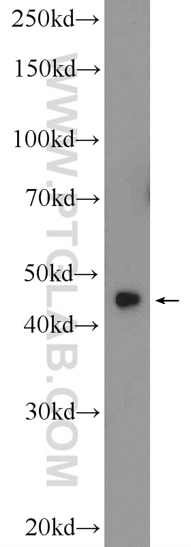 Western Blot (WB) analysis of HEK-293 cells using ZNF320 Polyclonal antibody (24882-1-AP)