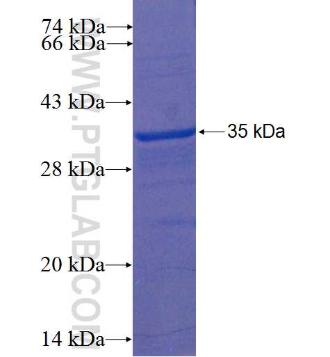 ZNF322A fusion protein Ag22406 SDS-PAGE