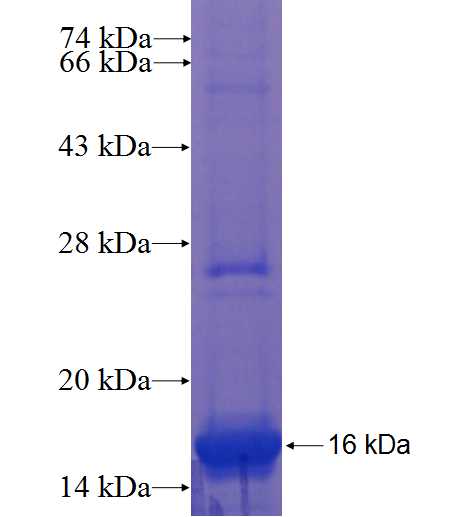 ZNF323 fusion protein Ag22372 SDS-PAGE