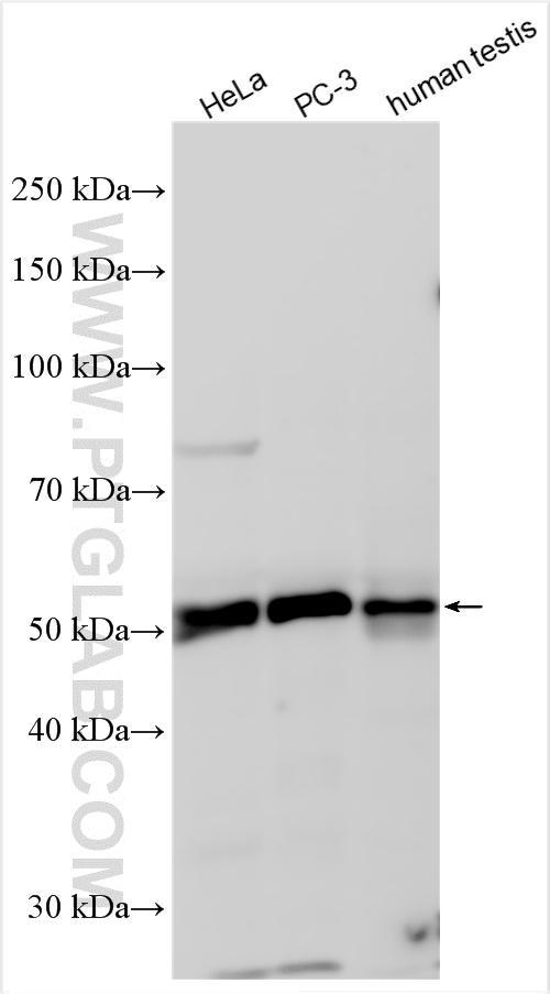 Western Blot (WB) analysis of various lysates using ZNF35 Polyclonal antibody (16935-1-AP)